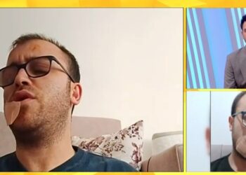 He was attacked in front of his house / The investigative journalist recounts the moment: There were three people, I pulled out a knife and hit them, everything happened very quickly