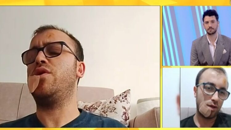 He was attacked in front of his house / The investigative journalist recounts the moment: There were three people, I pulled out a knife and hit them, everything happened very quickly