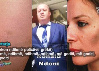 Scandal in “Fiks Fare” / Consulate employee beats citizens: I will break your ribs, pelvis, get out!