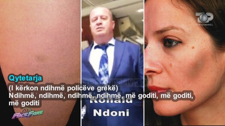 Scandal in “Fiks Fare” / Consulate employee beats citizens: I will break your ribs, pelvis, get out!