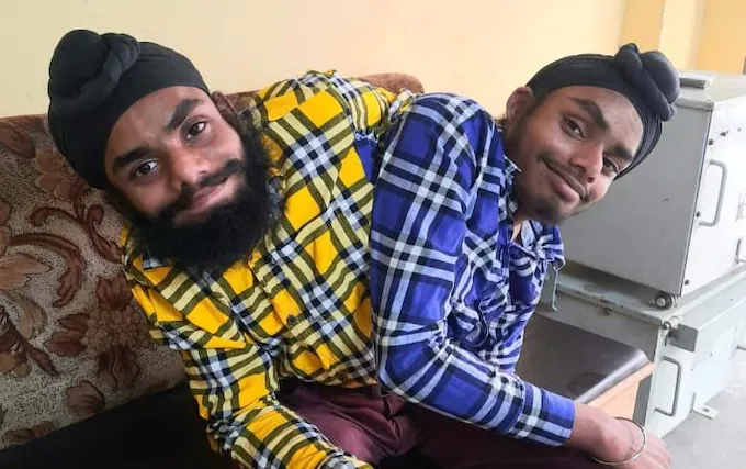 Adjoining twins, abandoned by parents win first job, with two salaries (photos)