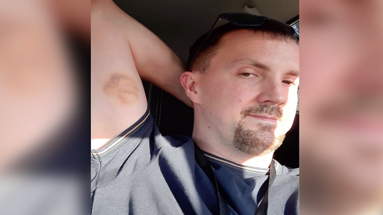 The face of Christ appears on the skin, the shocked 37-year-old!