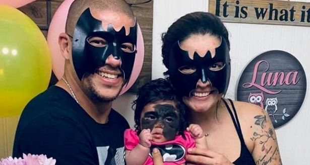 The little one finally loses the facial marks in the shape of “Batman” after two years of operations (photos)