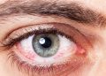 Eye color and shape, health connection