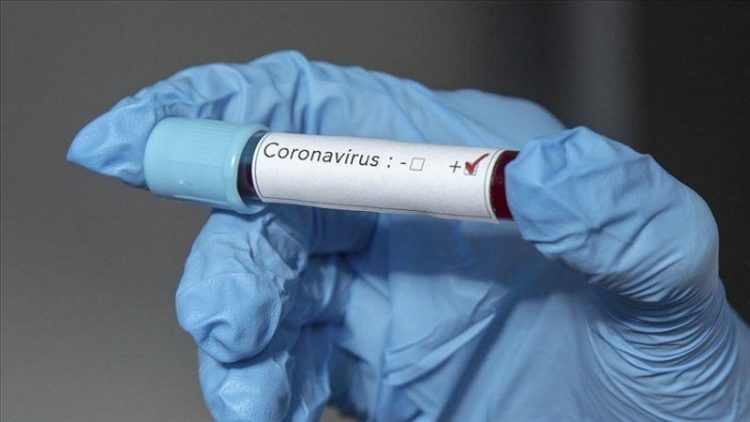 Six victims from COVID in Kosovo, 1,283 infected in the last 24 hours