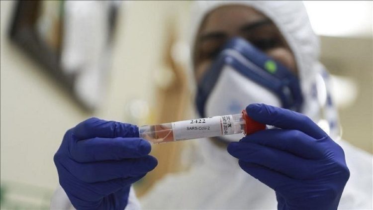 643 infected with COVID and four victims in Kosovo in 24 hours