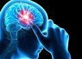 Rare types of headaches, health reasons why they occur