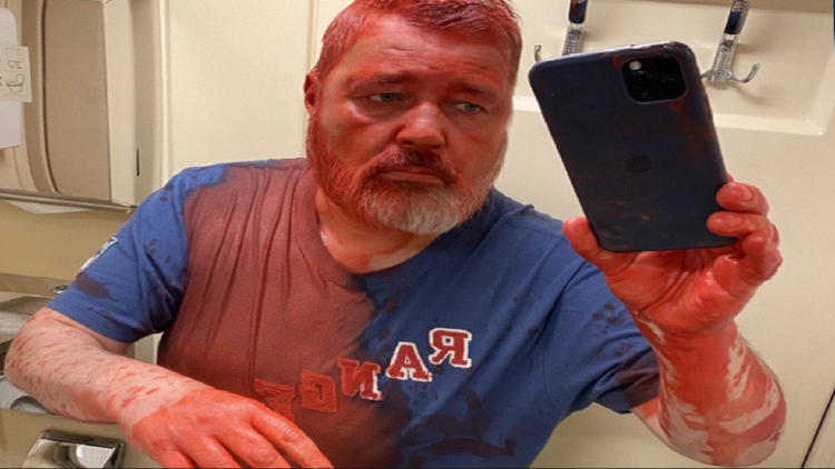 “This is for your sons”, the critical Nobel laureate of the Russian government is attacked with paint