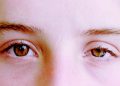 Drop of Eyelids. Not just an aesthetic problem!