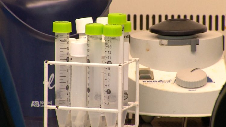 Monkey pox tests arrive / There are 250 tests to be used for suspected cases of infection