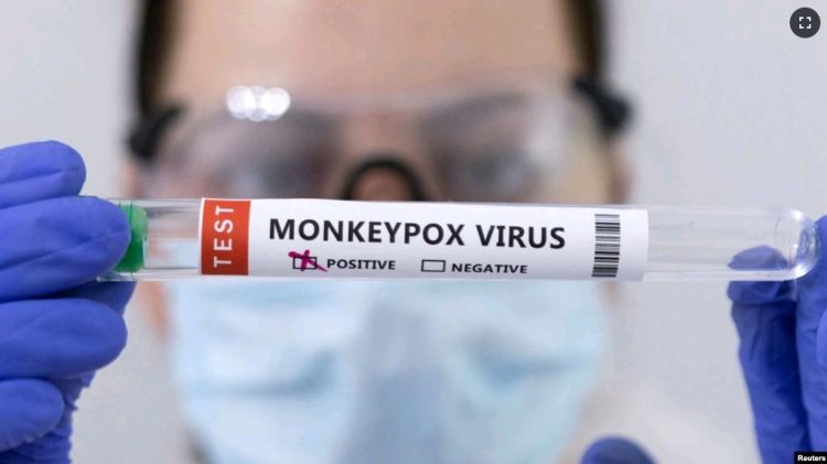 The line of monkeys very close to us?  A suspected case in Kosovo
