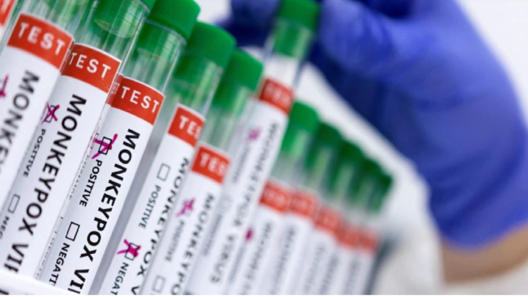 It was suspected that there was a “monkey line”, the patient in Kosovo is negative