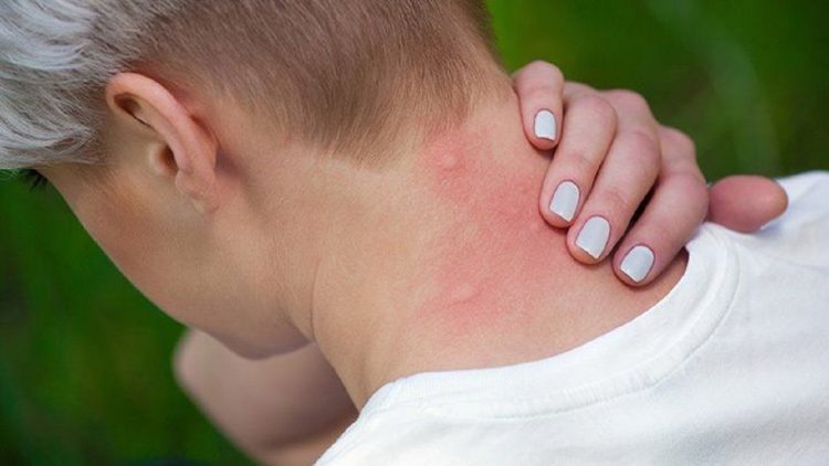 If you want to say goodbye to mosquitoes plant this plant in your home