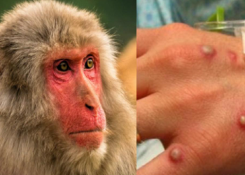 Global emergency!  WHO announces the alert for monkeypox: More than 16 thousand cases are reported