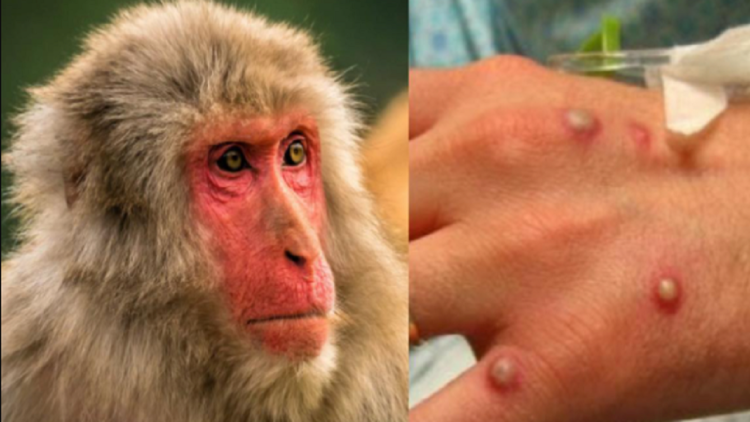 Global emergency!  WHO announces the alert for monkeypox: More than 16 thousand cases are reported