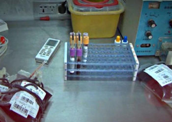 Scientists discover the origin of Covid19?  Here is what is thought to be the source from which the deadly coronavirus pandemic began
