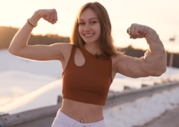 Born with one giant arm, the young woman from the USA confesses: They advise me…