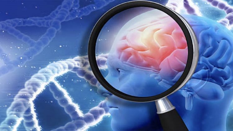 The six initial signs of sclerosis, how to recognize them