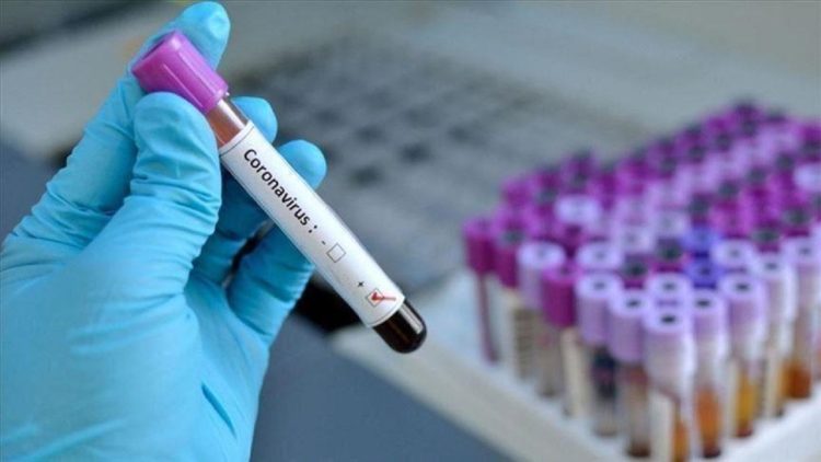 Increase in Covid infections in Kosovo, nearly 900 infected within a day